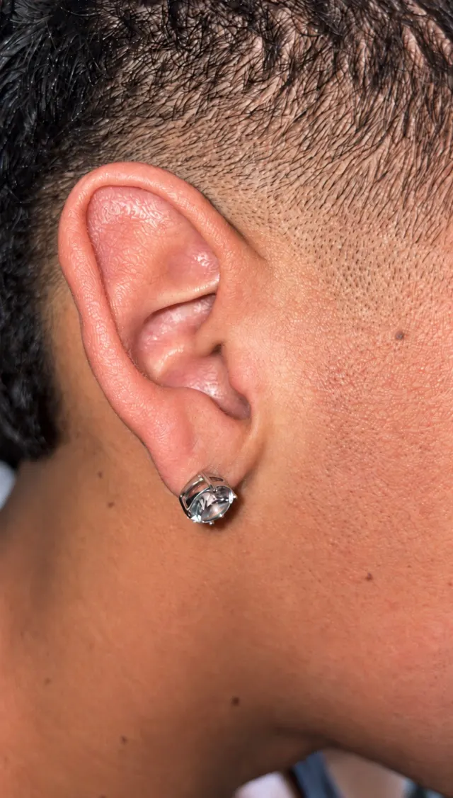 Ear after using the Earwand: loose hairs removed