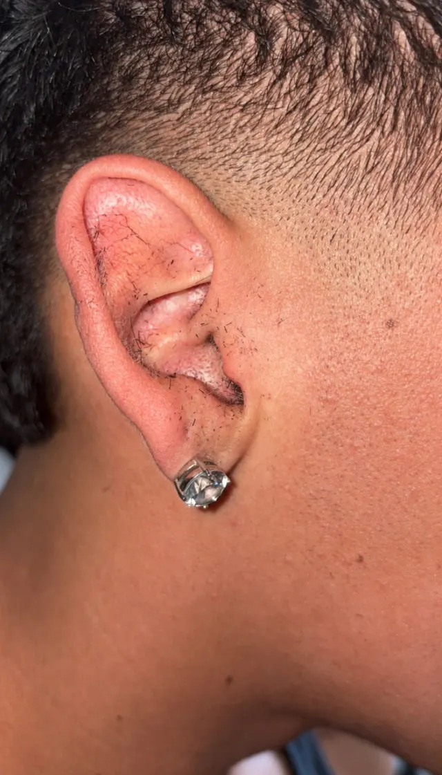 Ear right after a haircut, with loose hairs